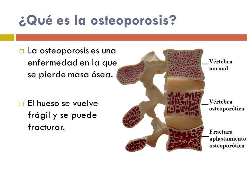 El mejor alimento para la osteoporosis